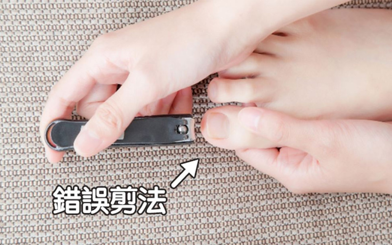 日診所公開「剪腳指甲的正確方法」學起來讓你走路不再疼！網：原來一直都剪錯！